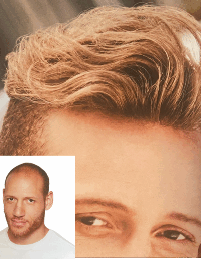 men hair system before and after