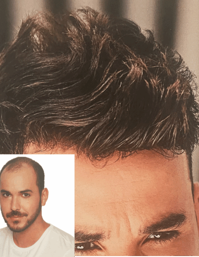 men hair system before and after