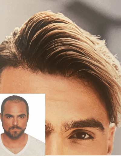 men hair system before and after