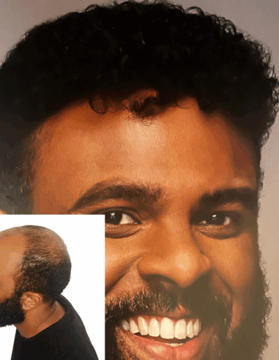 men hair system before and after